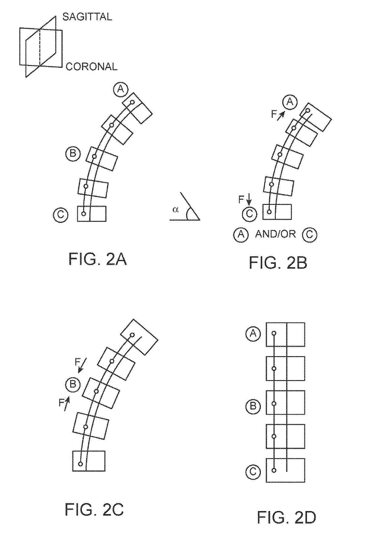 Spinal Curvature Modulation Systems and Methods