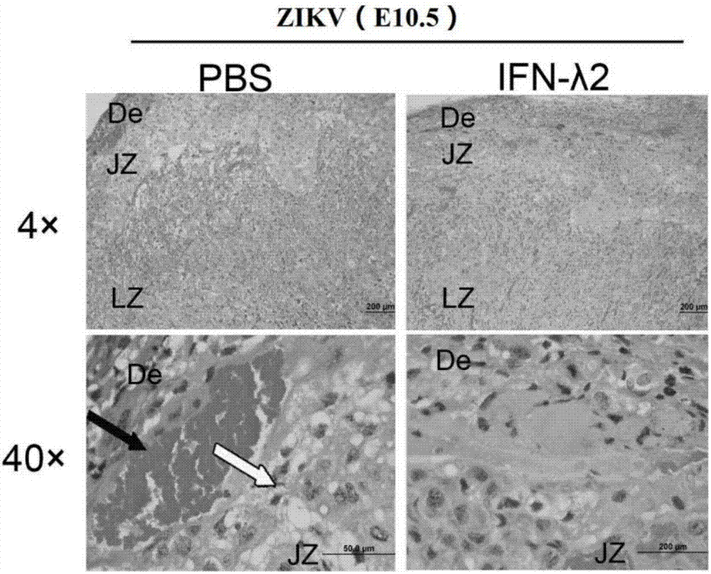 Novel application of IFN-lambda in Zika virus infection