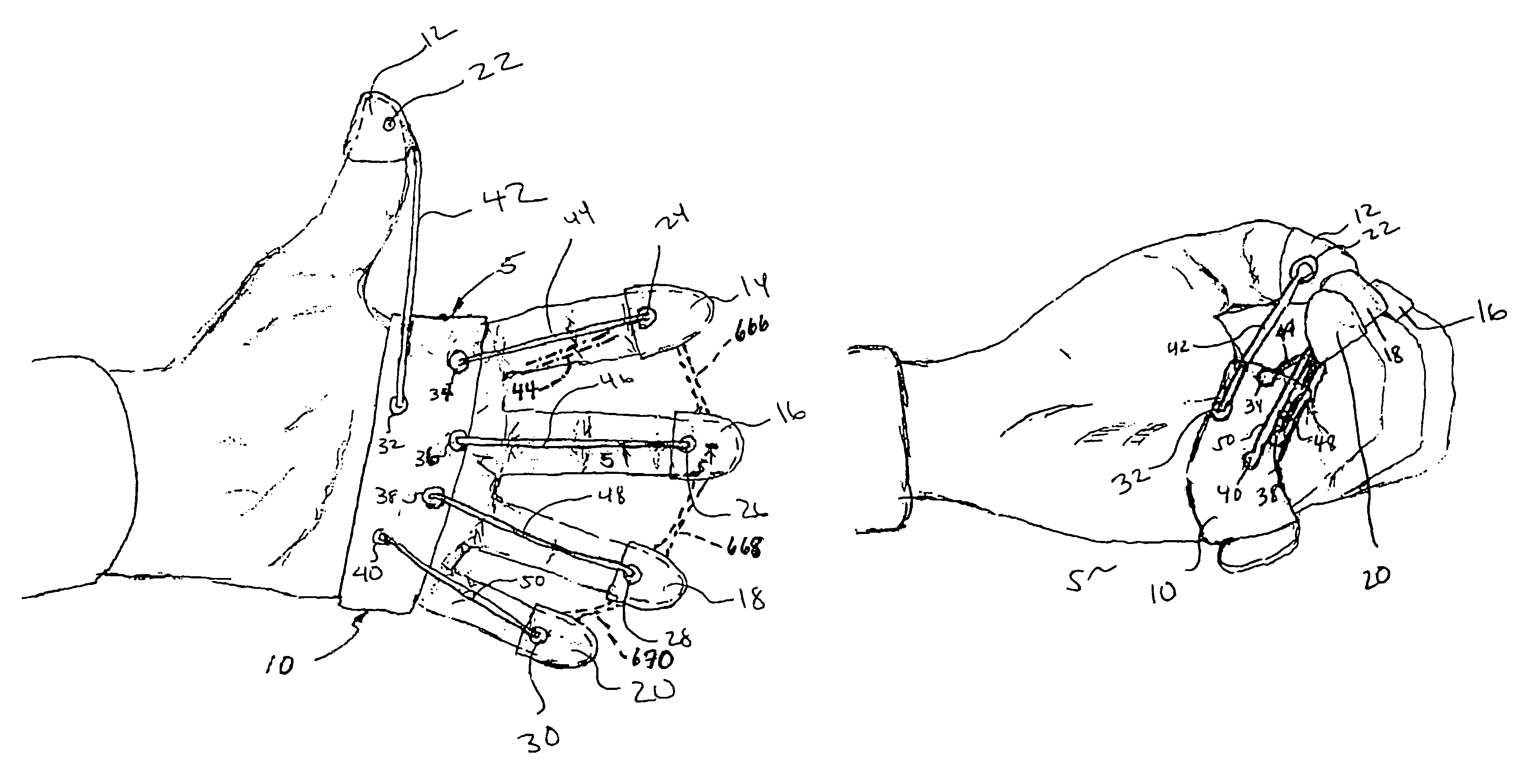 Hand exercising device