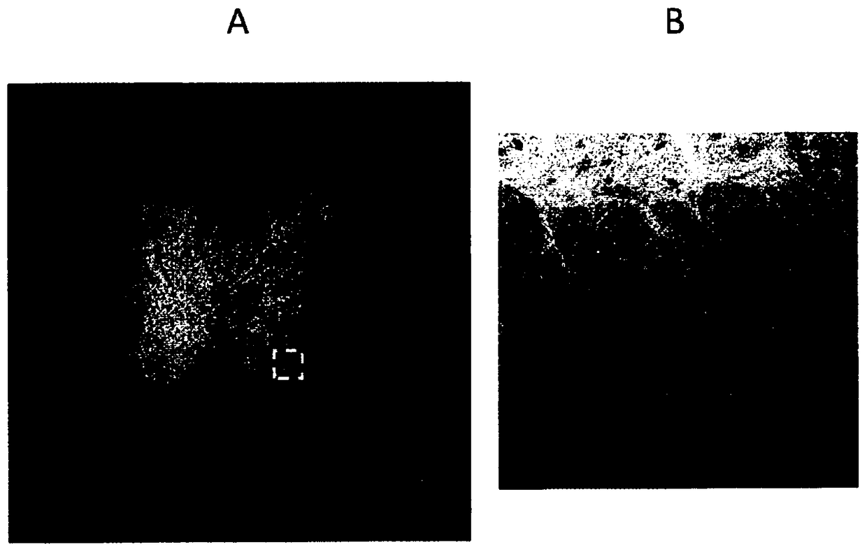 Tissue clearing method, tissue clearing reagent and tissue observation method