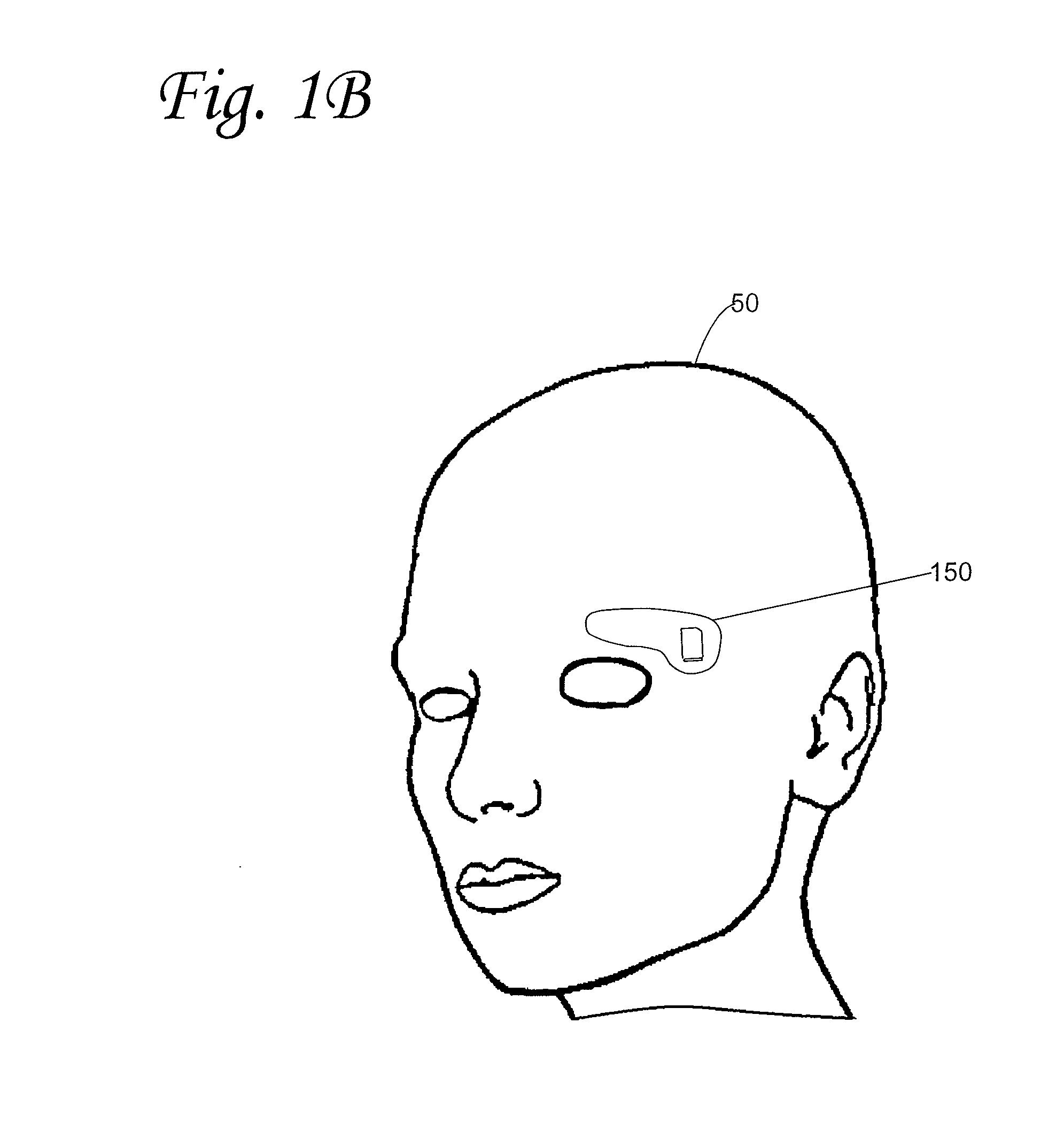 Systems, devices, and methods for monitoring a subject