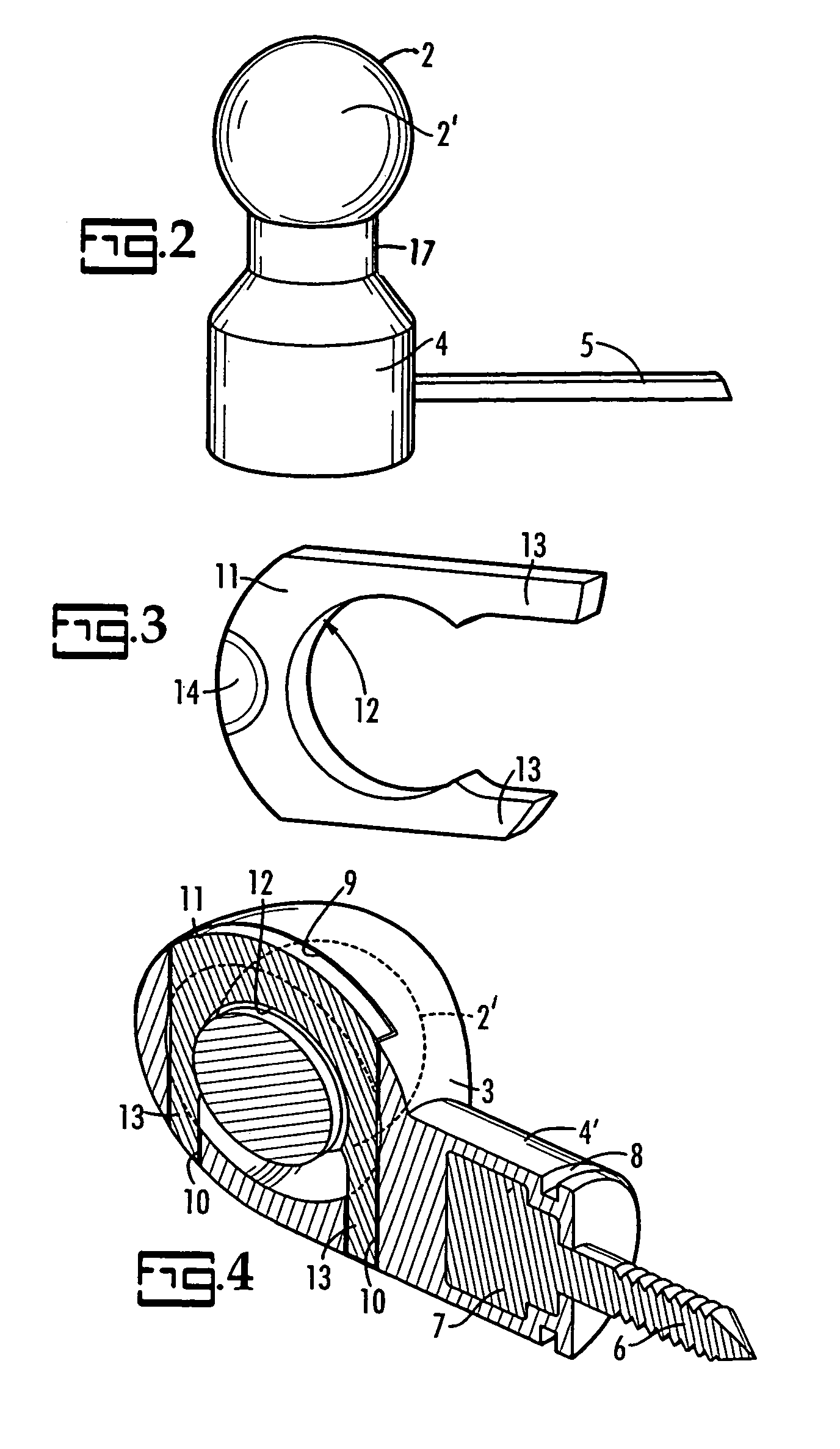 Ball joint for a device used for accelerating jaw growth