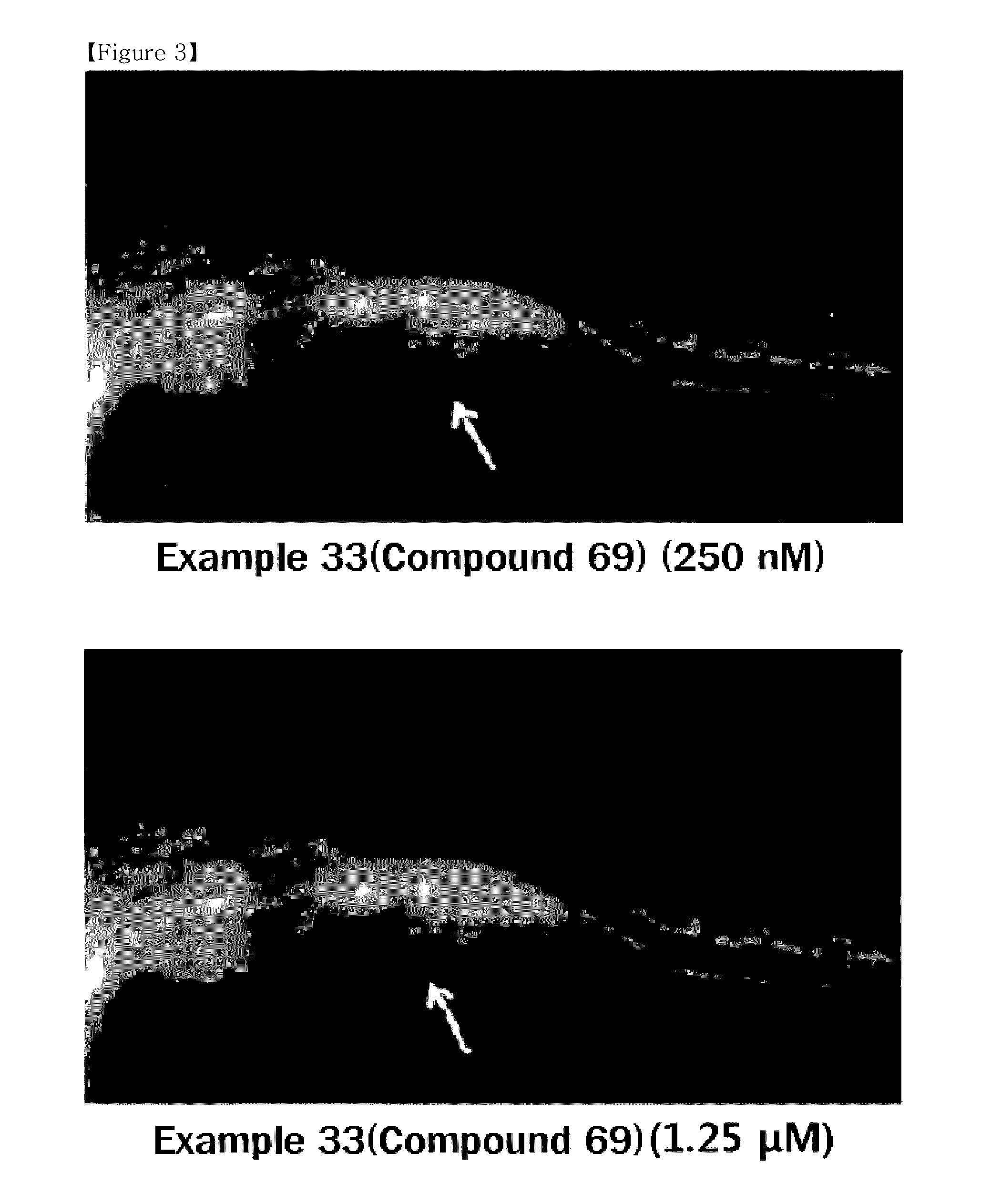 Novel compound or pharmaceutically acceptable salt thereof, and pharmaceutical composition containing same as active ingredient