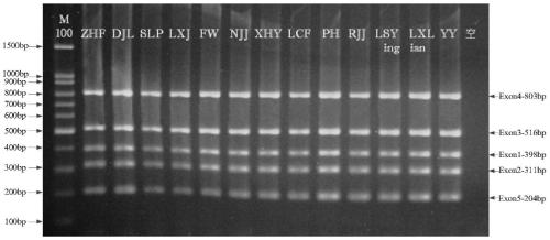 Primer group for detection of vitamin E metabolism gene TTPA (tocopherol (Alpha) transfer protein) and multiple PCR (polymerase chain reaction) detection method