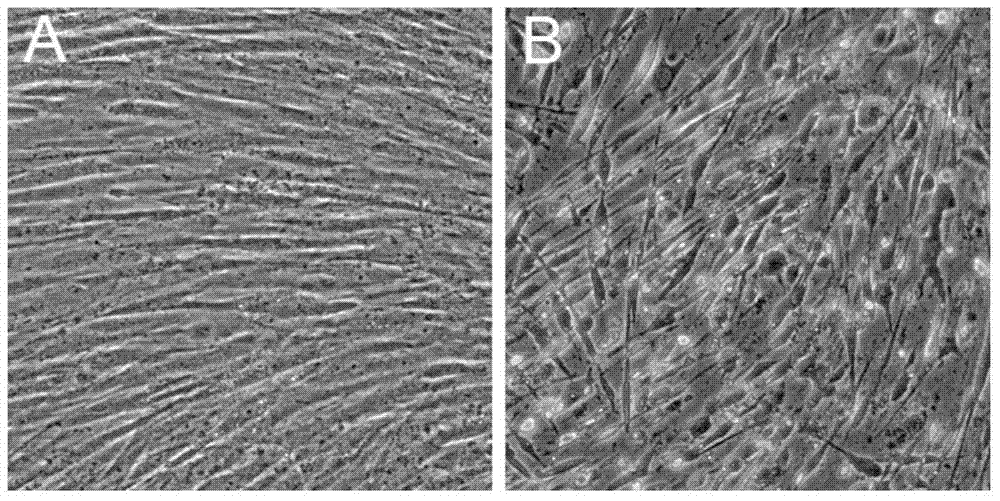 A method for inducing and differentiating inner ear hair cells from human bone marrow mesenchymal stem cells