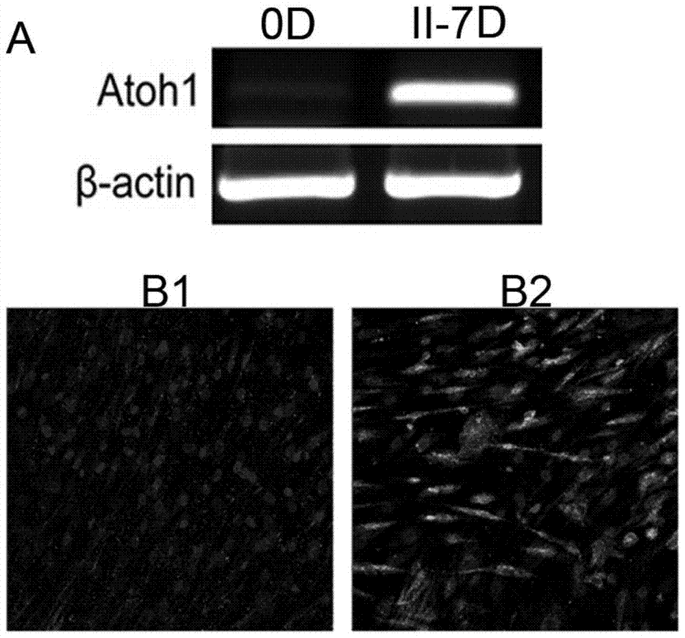 A method for inducing and differentiating inner ear hair cells from human bone marrow mesenchymal stem cells