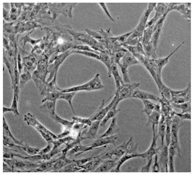 A method for inducing and differentiating inner ear hair cells from human bone marrow mesenchymal stem cells