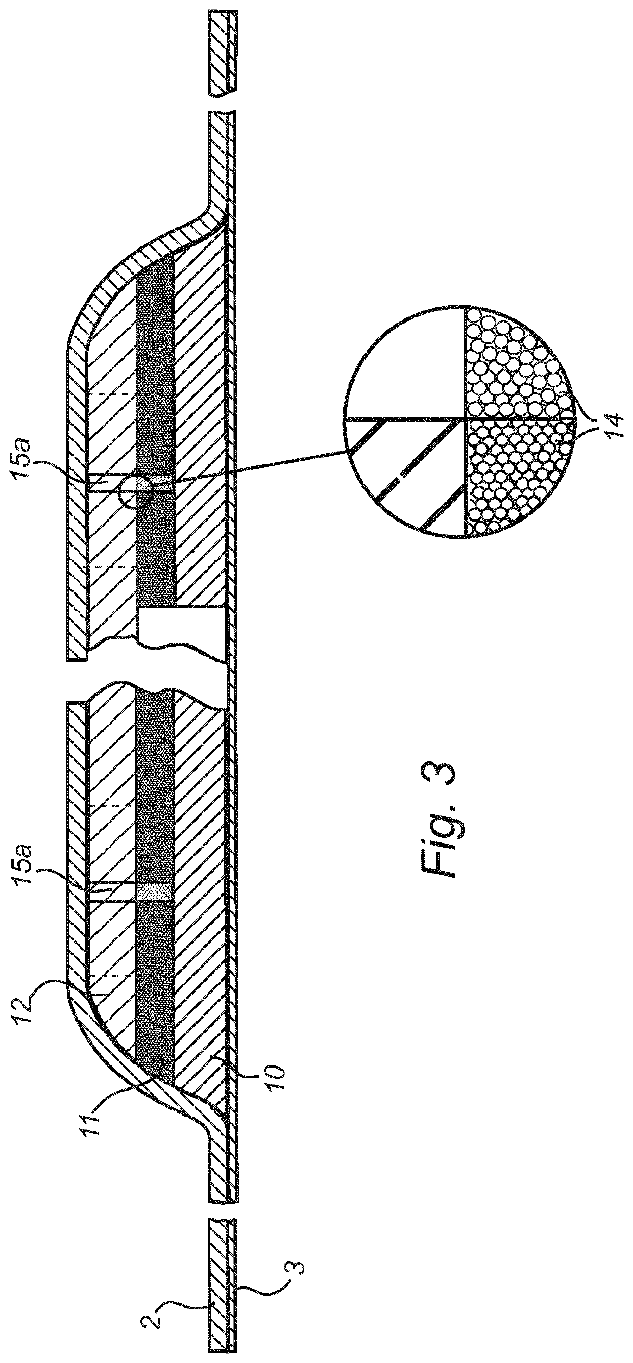 Wound pad and a self-adhesive member comprising a wound pad