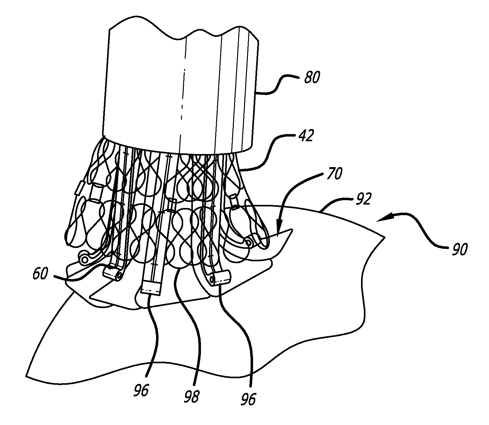 Medical Device Delivery System Having Integrated Introducer