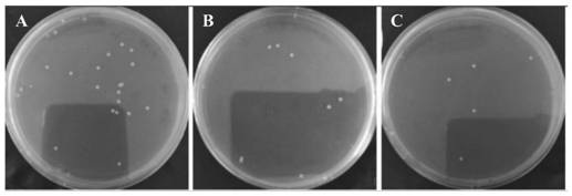 Vancomycin-modified black phosphorus quantum dot antibacterial agent and preparation method and application thereof