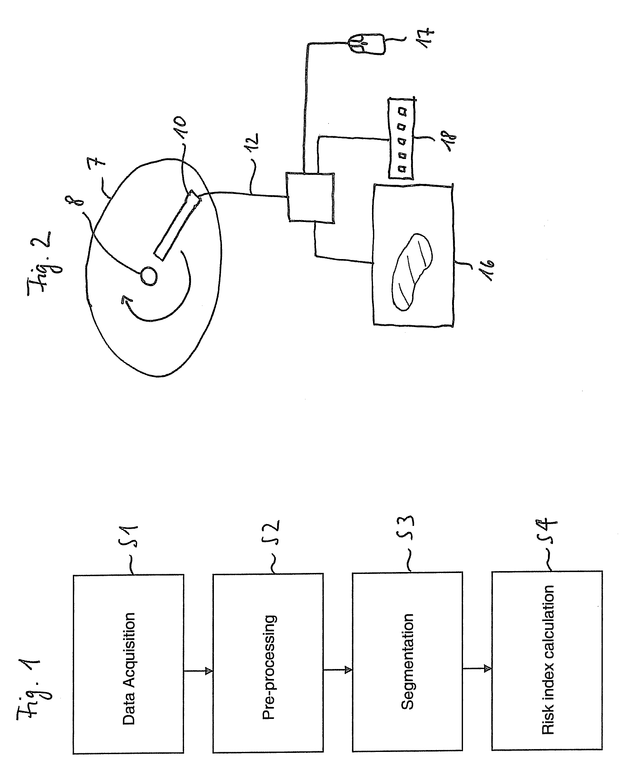 Method and system for breast cancer screening