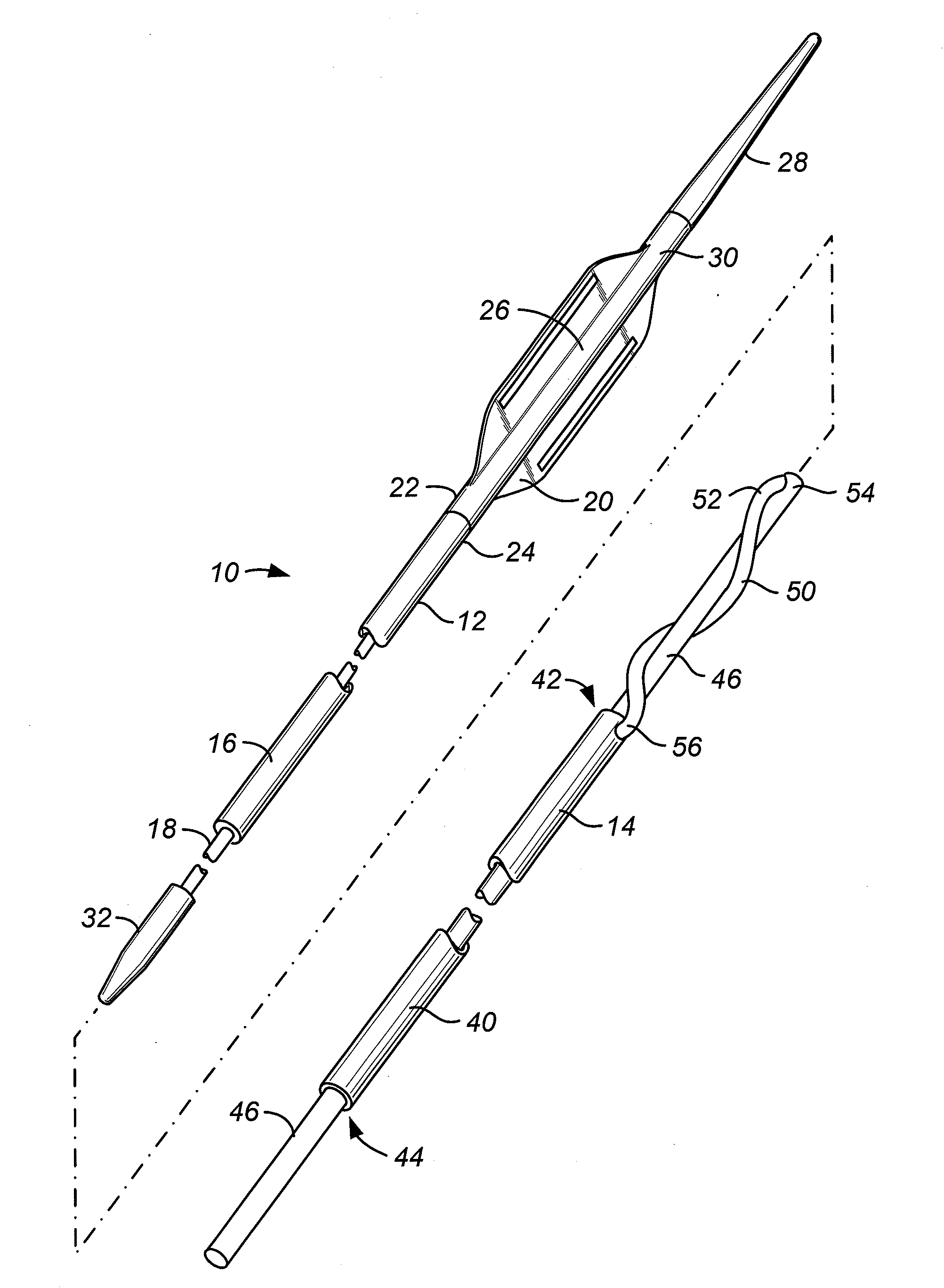 Systems and methods for stone removal