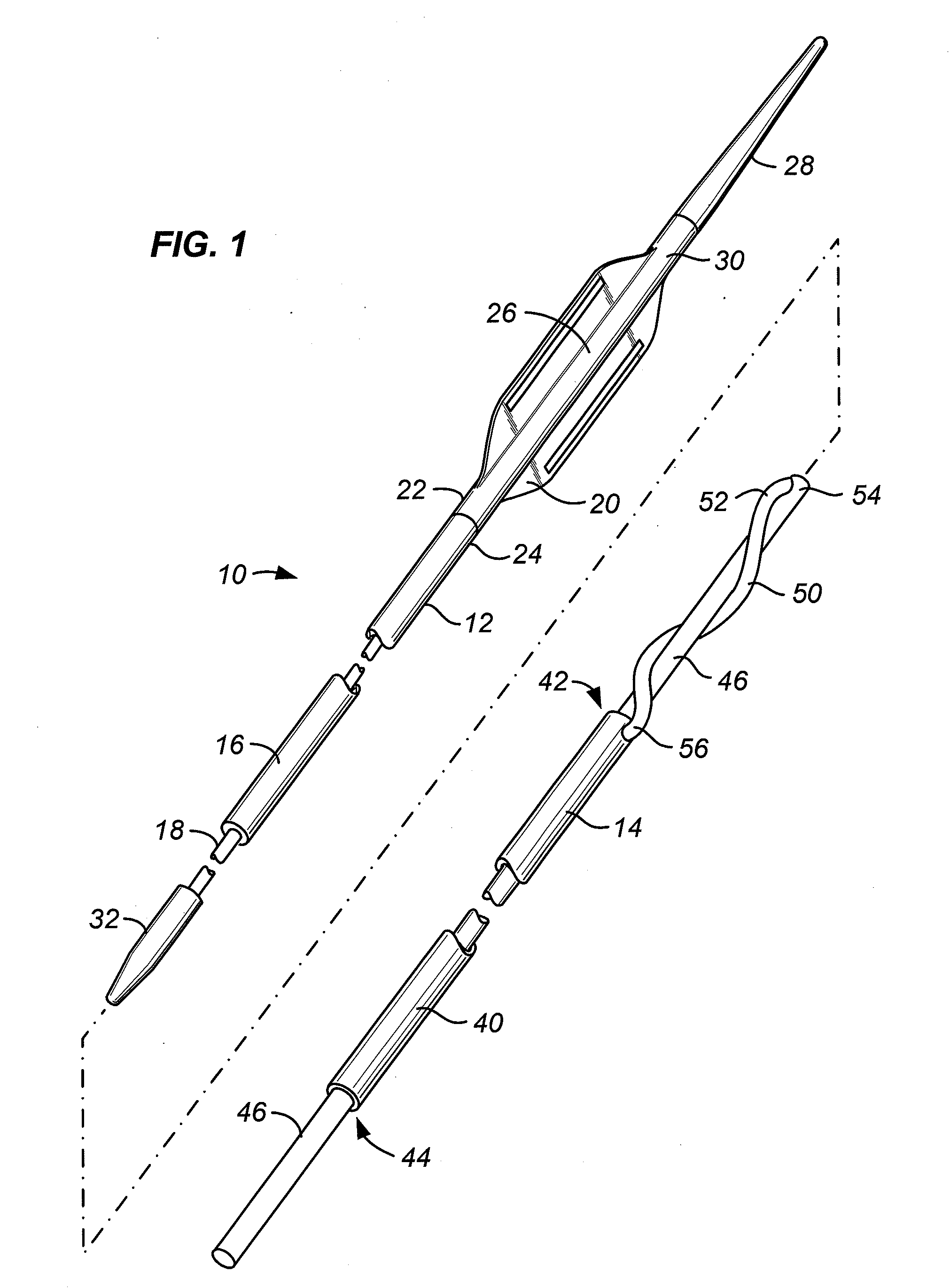 Systems and methods for stone removal
