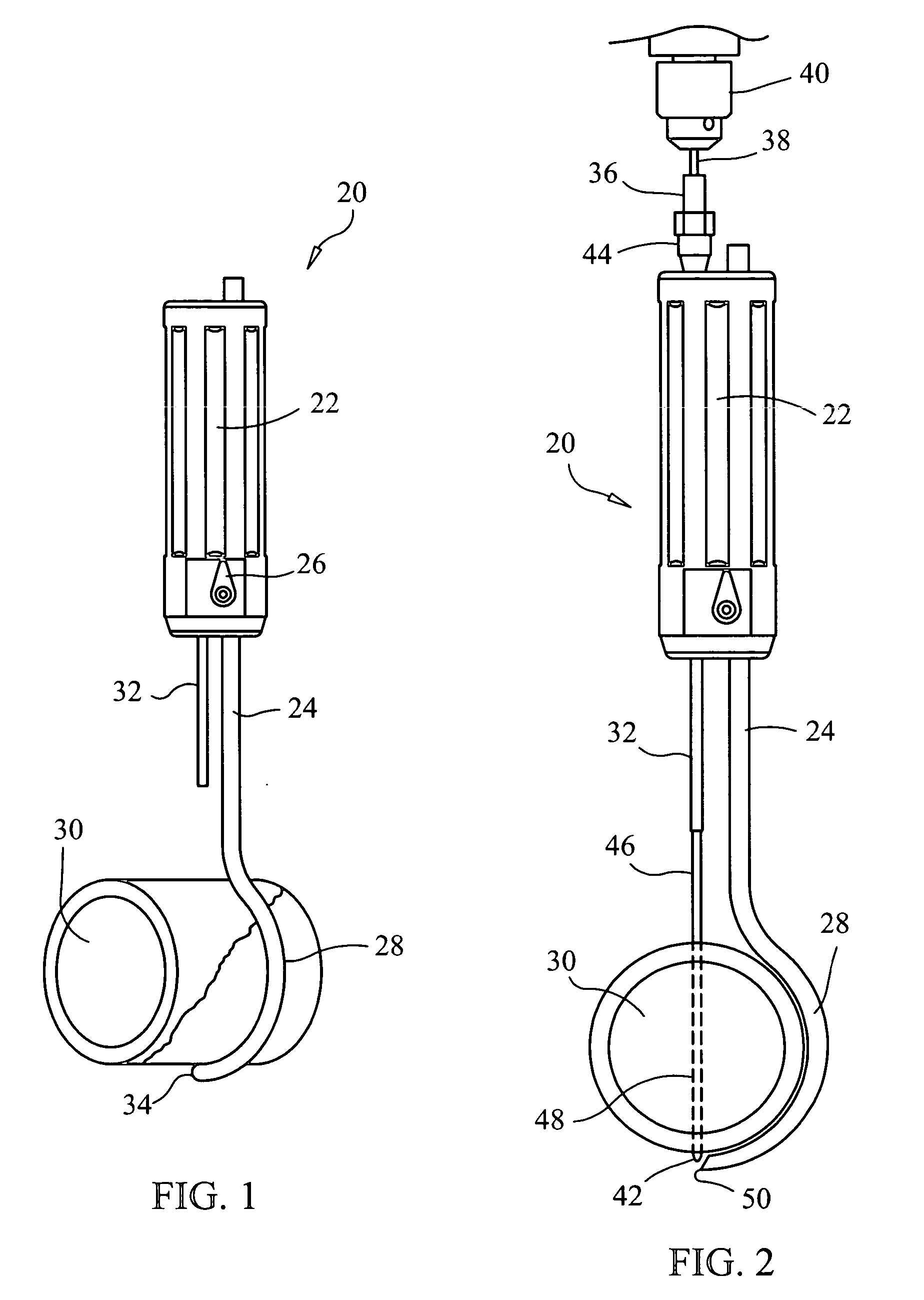 Apparatus and methods for surgery