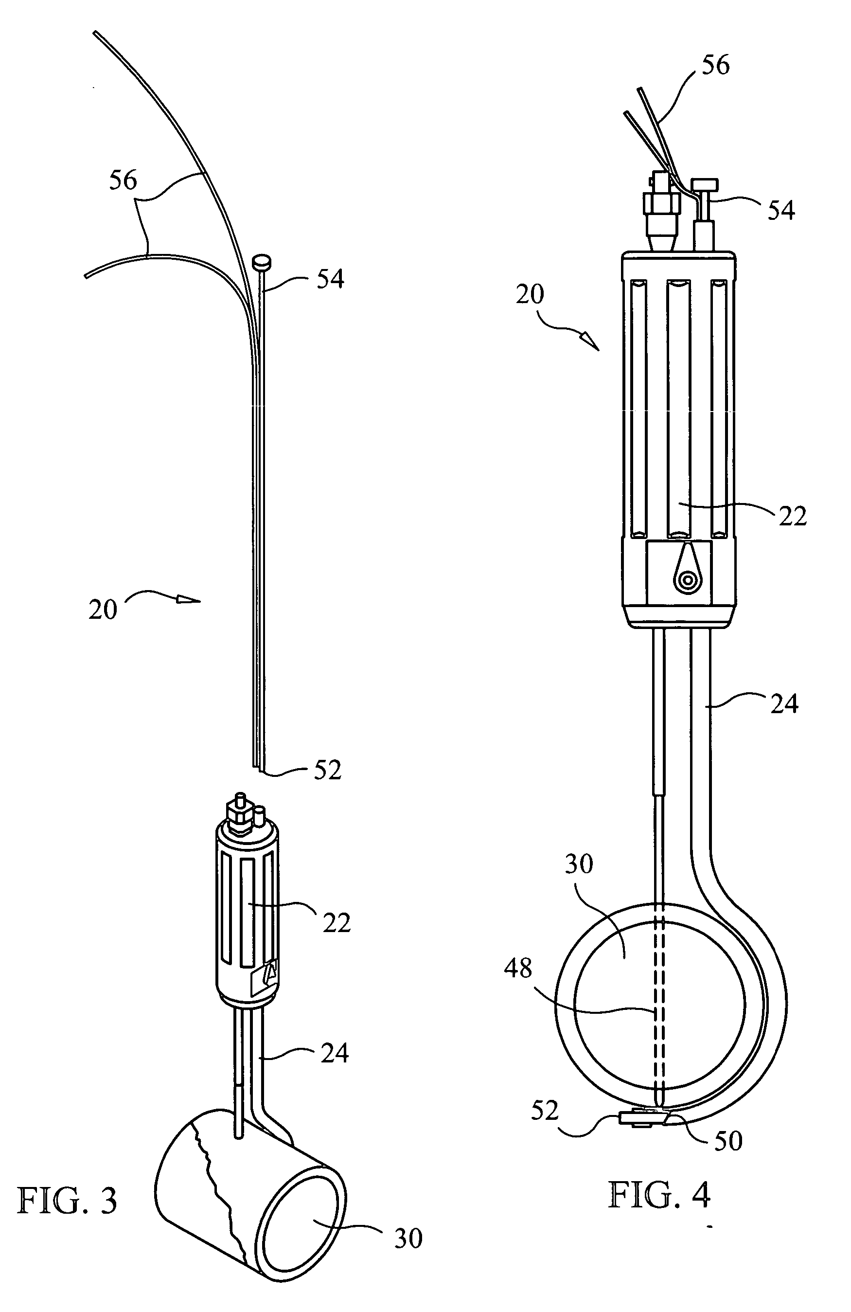 Apparatus and methods for surgery