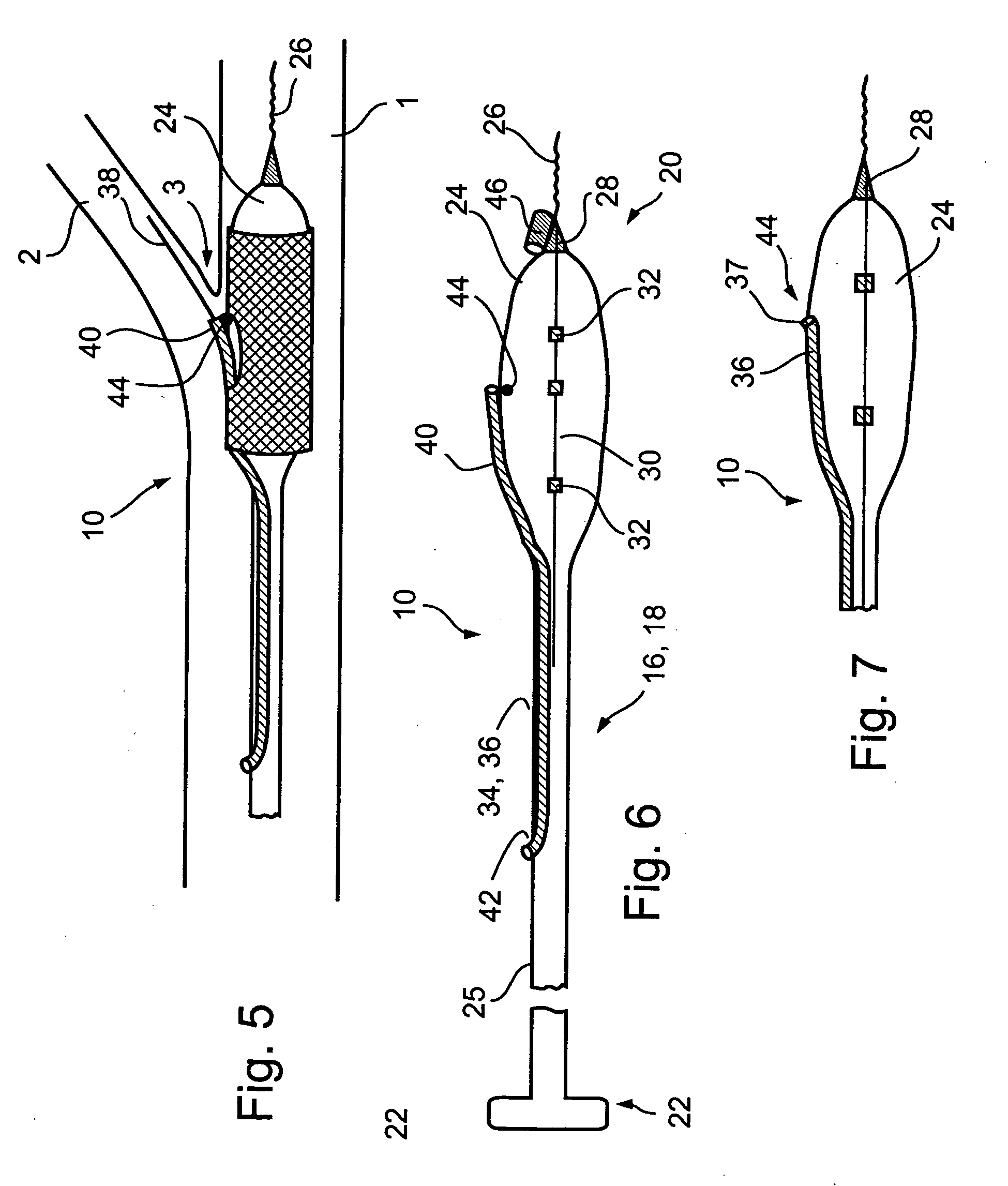 Bifurcation stent delivery devices
