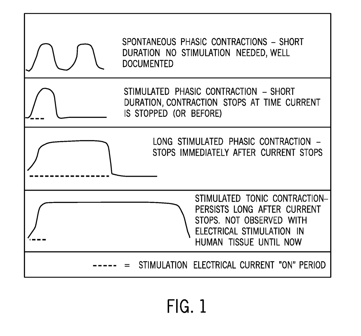 Uterine electrical stimulation system and method