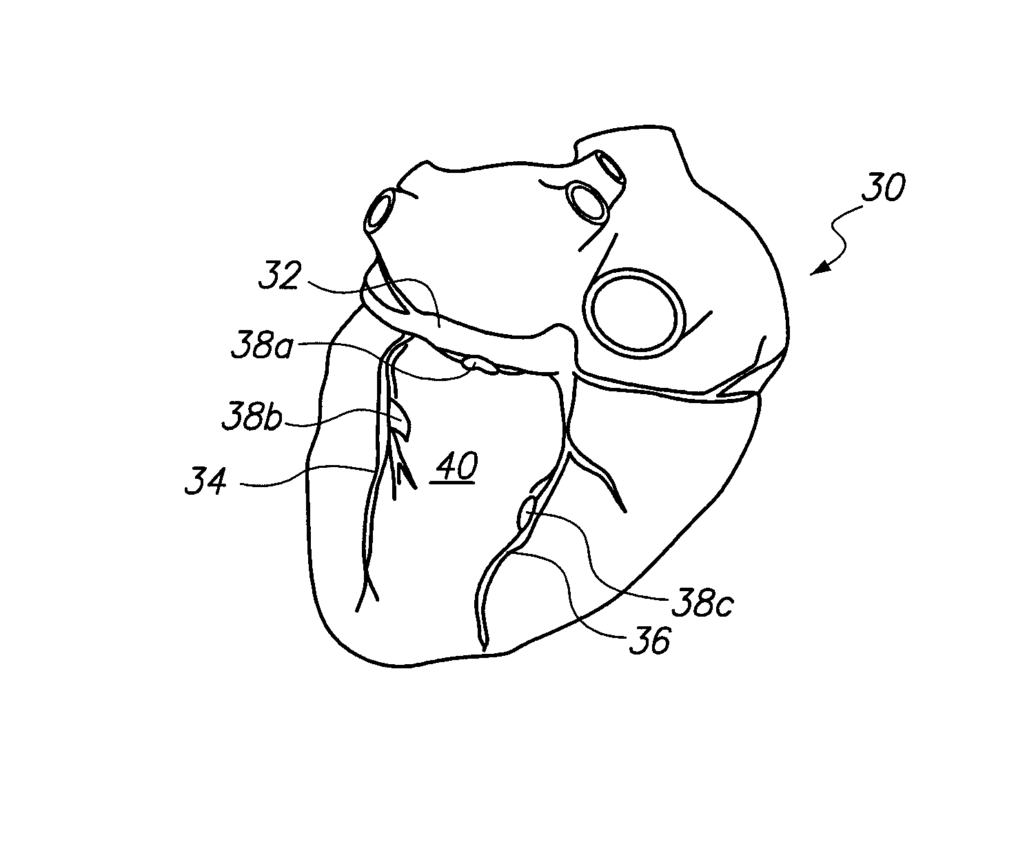 System and method for transvascular activation of cardiac nerves with automatic restart