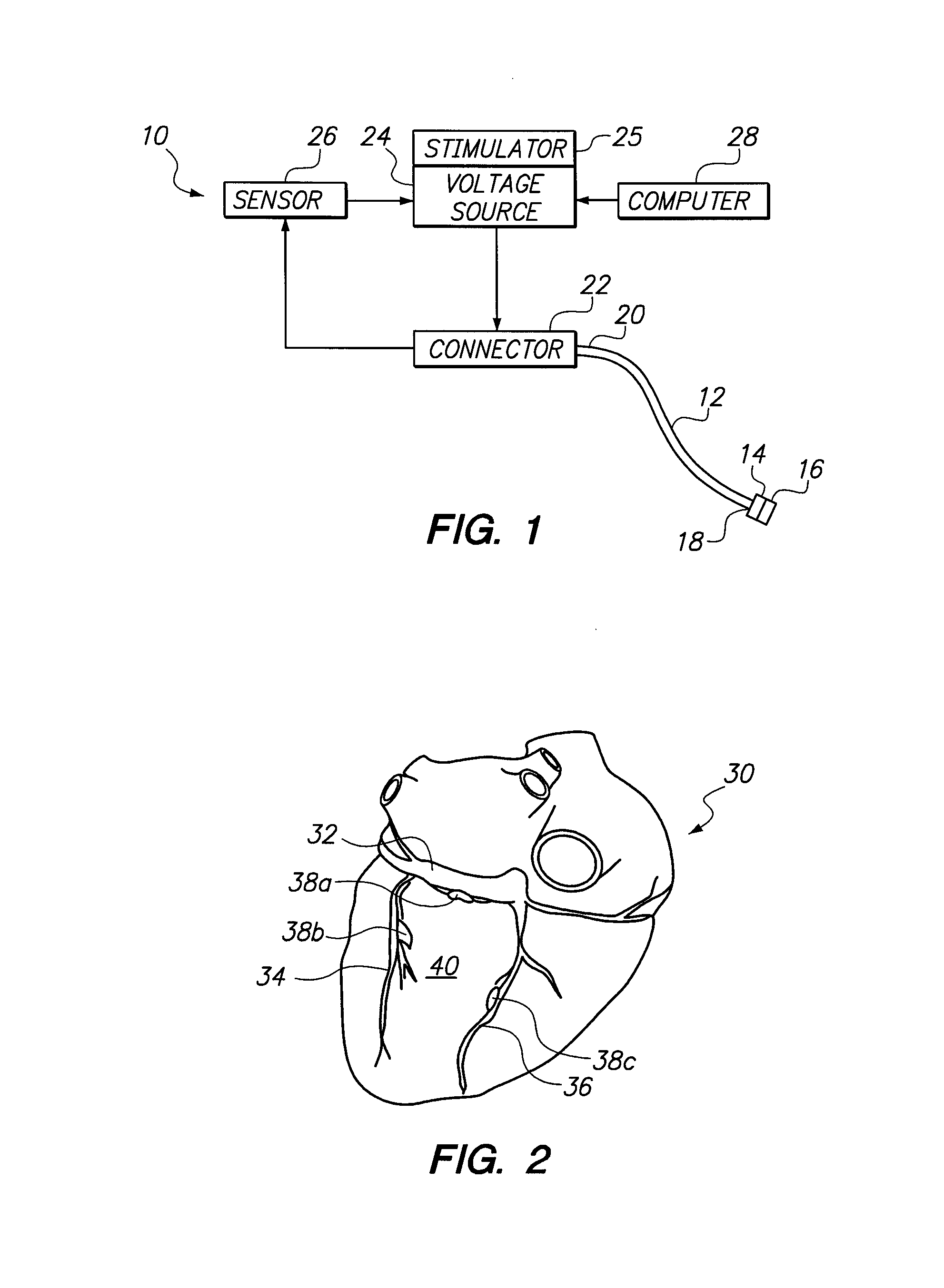 System and method for transvascular activation of cardiac nerves with automatic restart