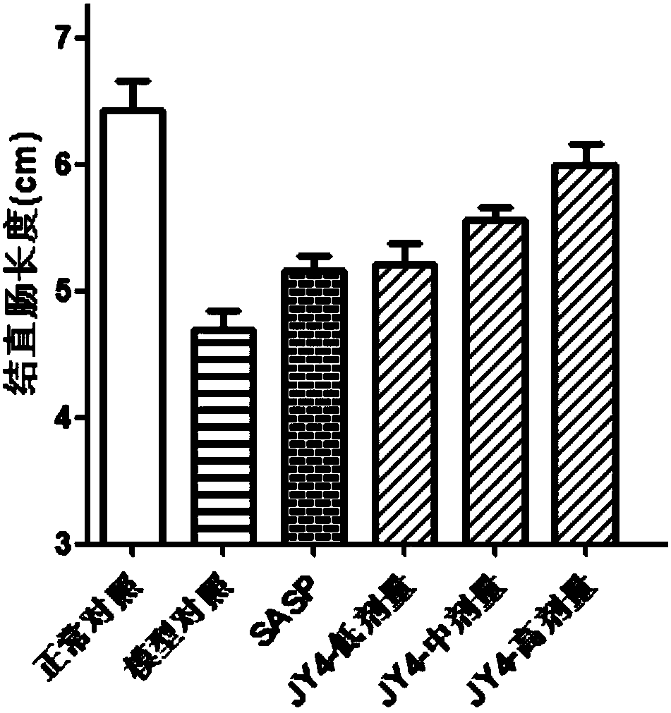 Application of sulfoxide compound in treatment of inflammatory bowel diseases