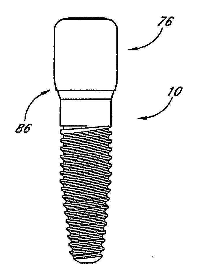 Dental implant system