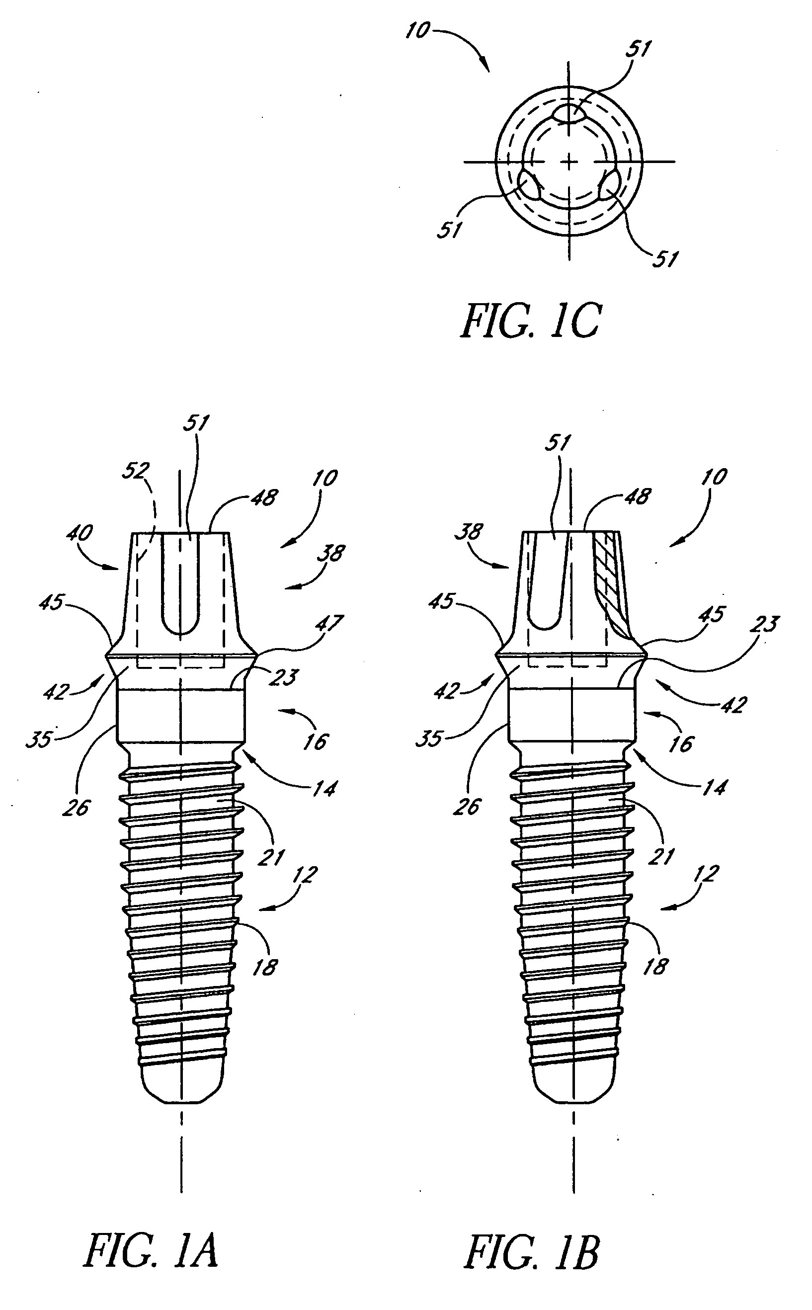 Dental implant system