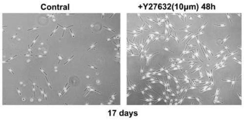 A method for efficiently isolating and culturing human primary melanocytes