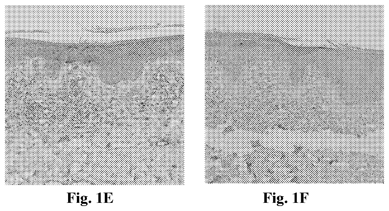 Fabp4 as a therapeutic target in skin diseases