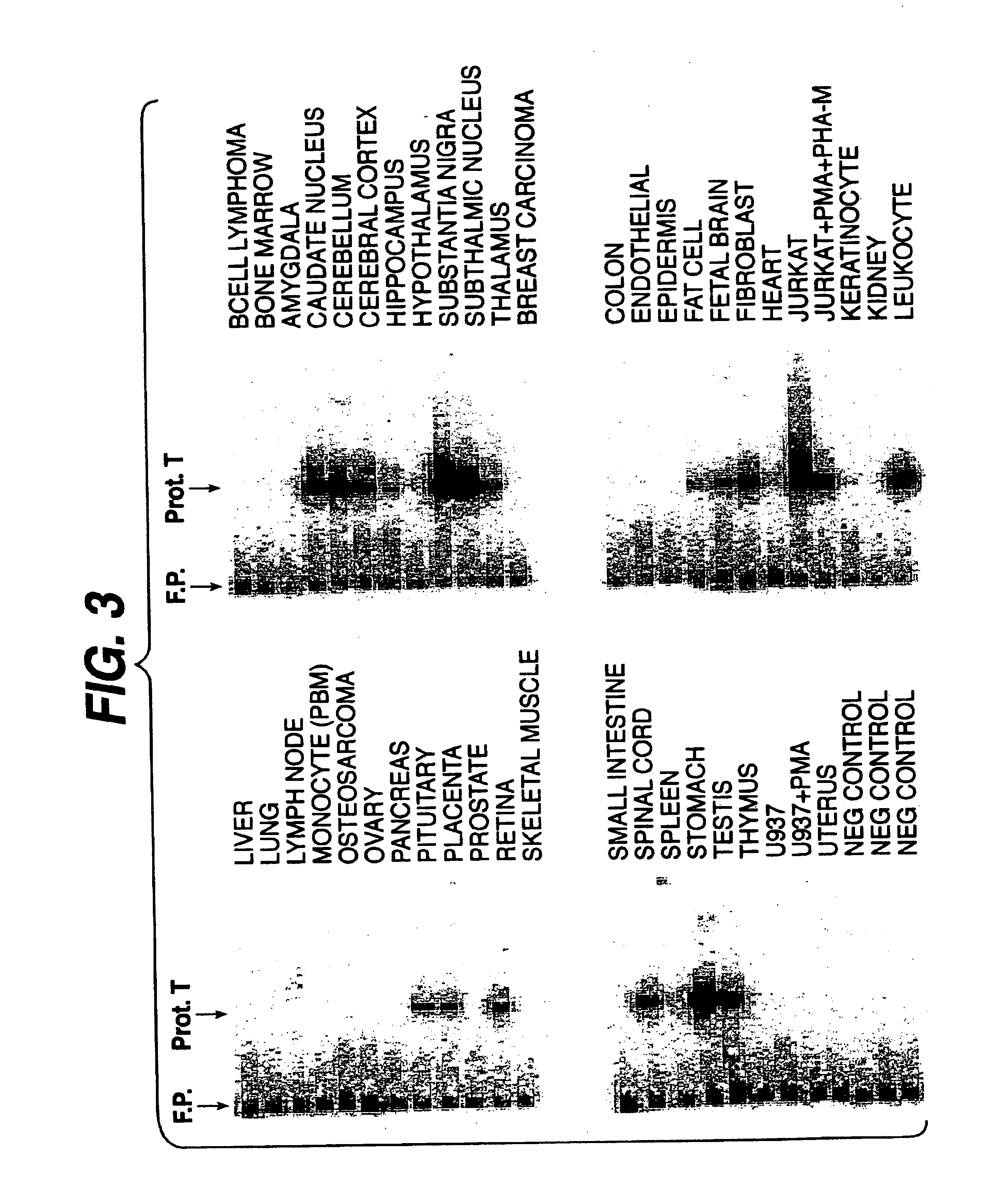 DNA encoding the human serine protease T