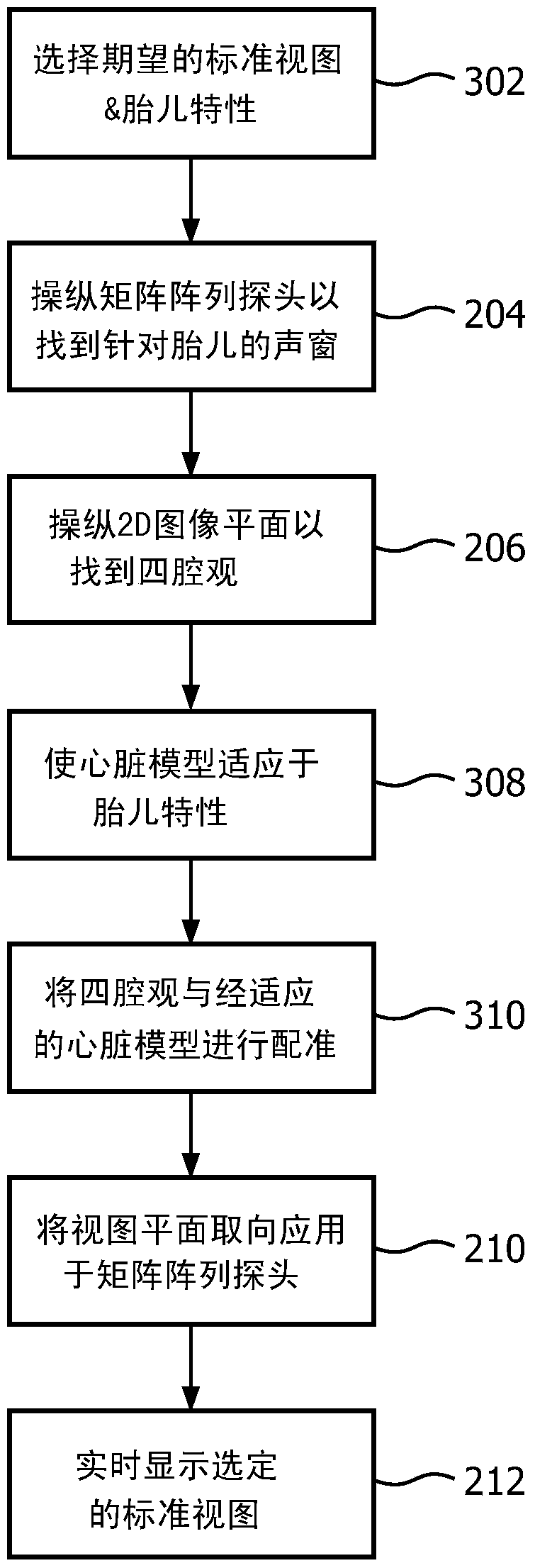 Automatic positioning of standard planes for real-time fetal heart assessment