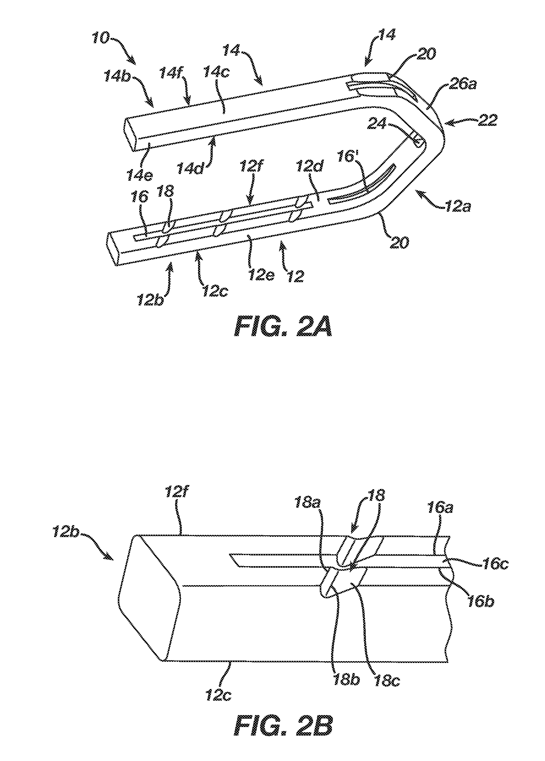 Surgical Clip Having Comliant Portion