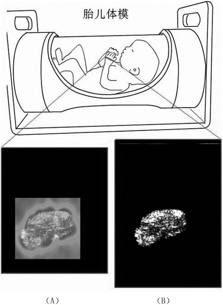 Automatic focusing method for ultrasonic elastography