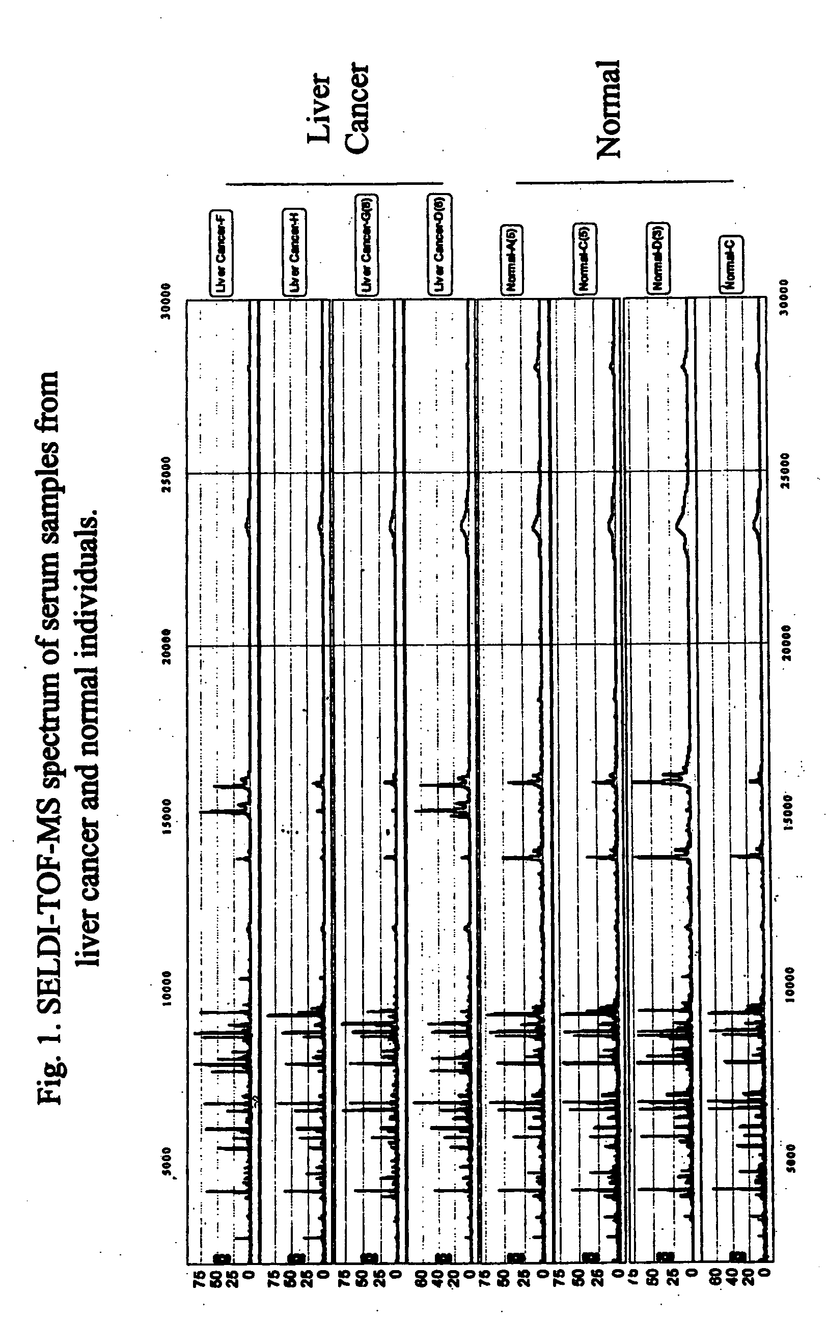 Method and compositions for detection of liver cancer