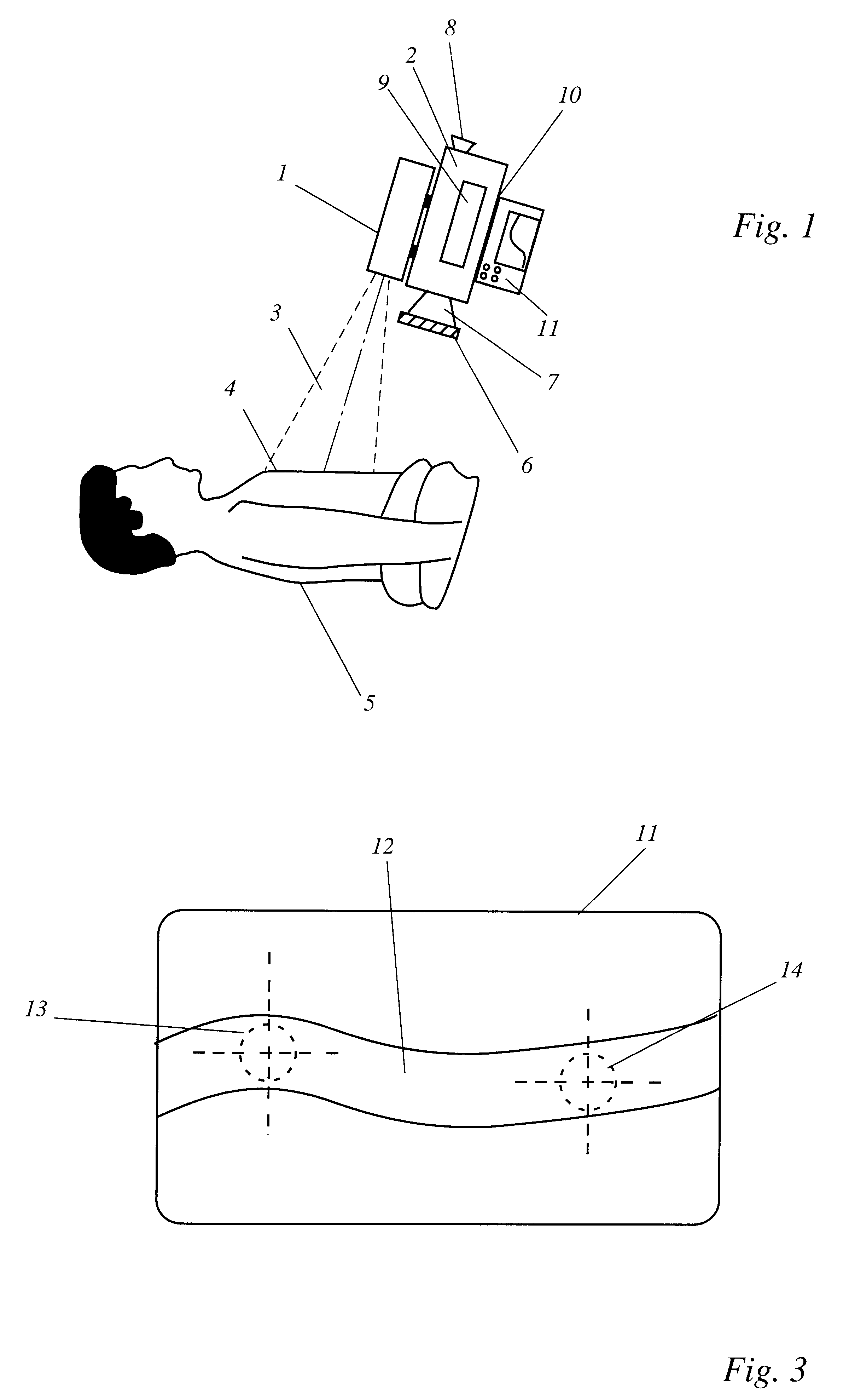 Method, device and computer program for determining the blood flow in a tissue or organ region
