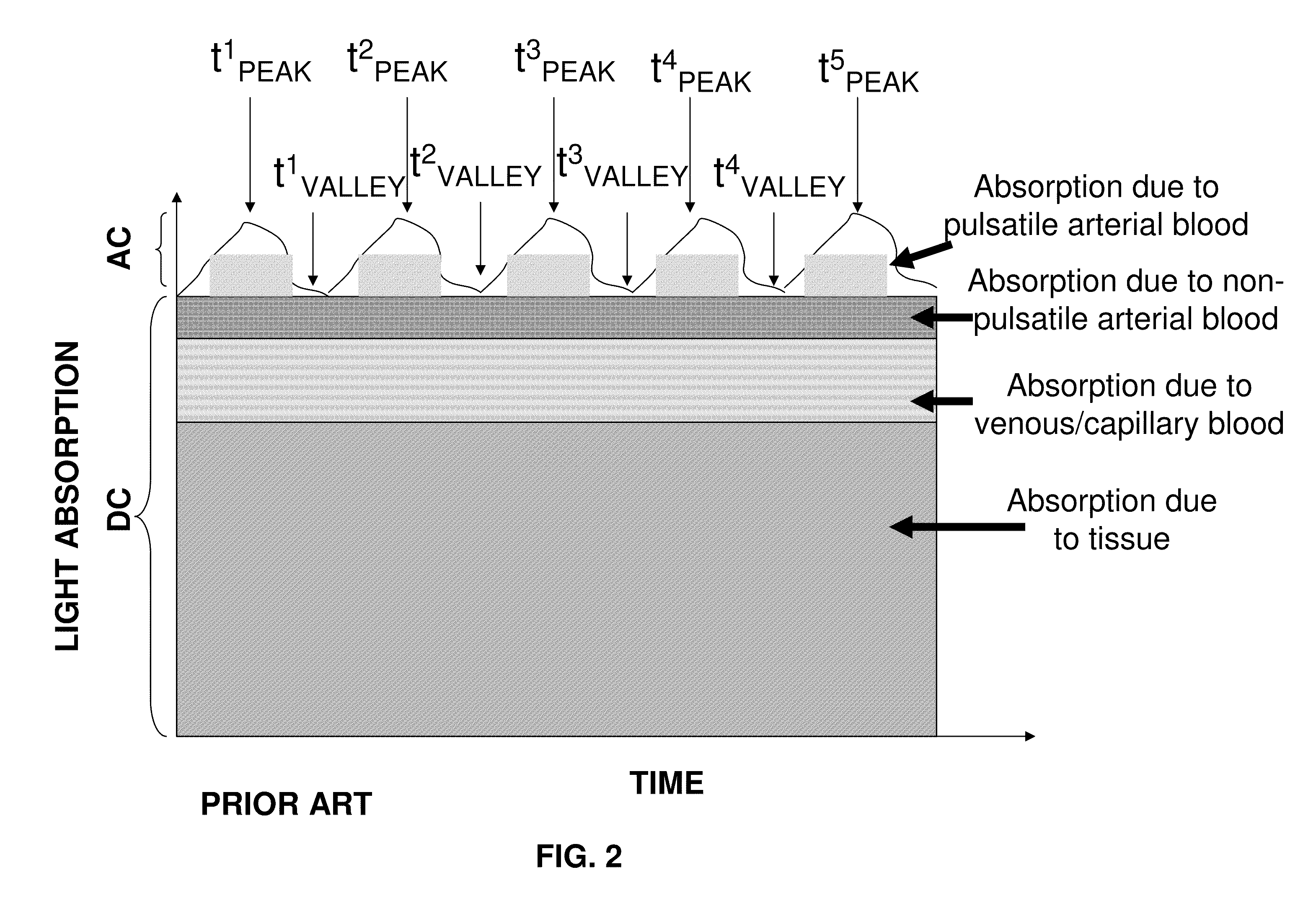 Photoplethysmography device and method