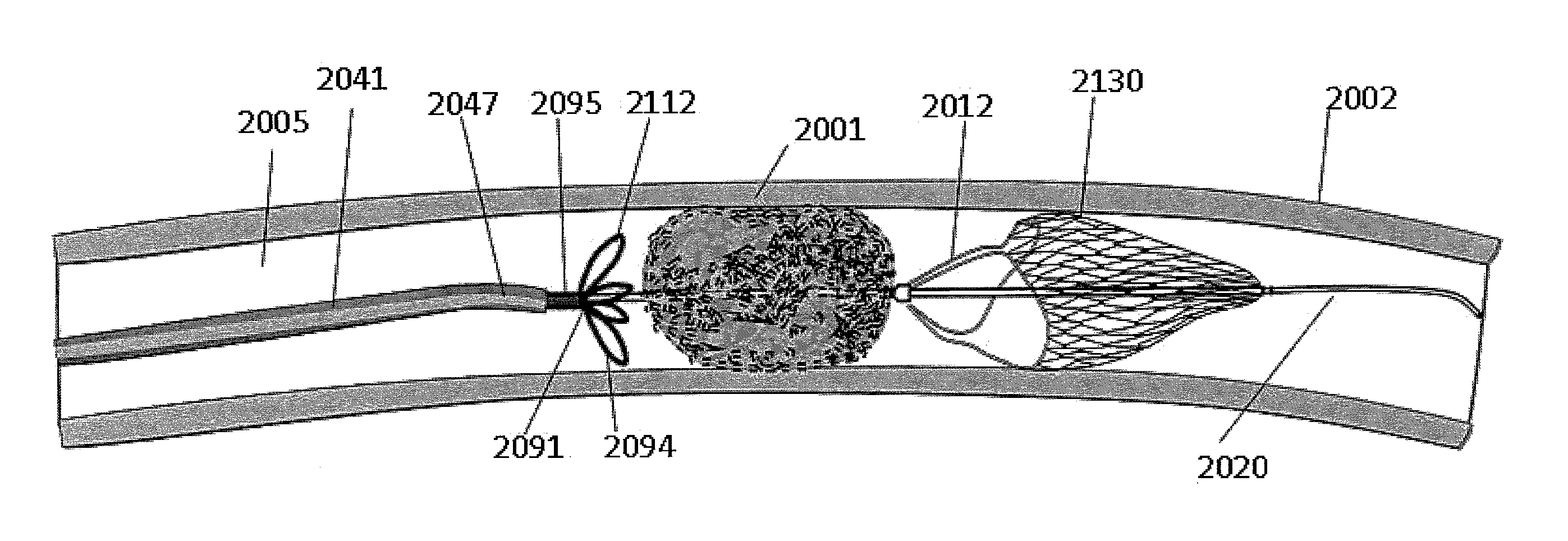 Clot capture systems and associated methods