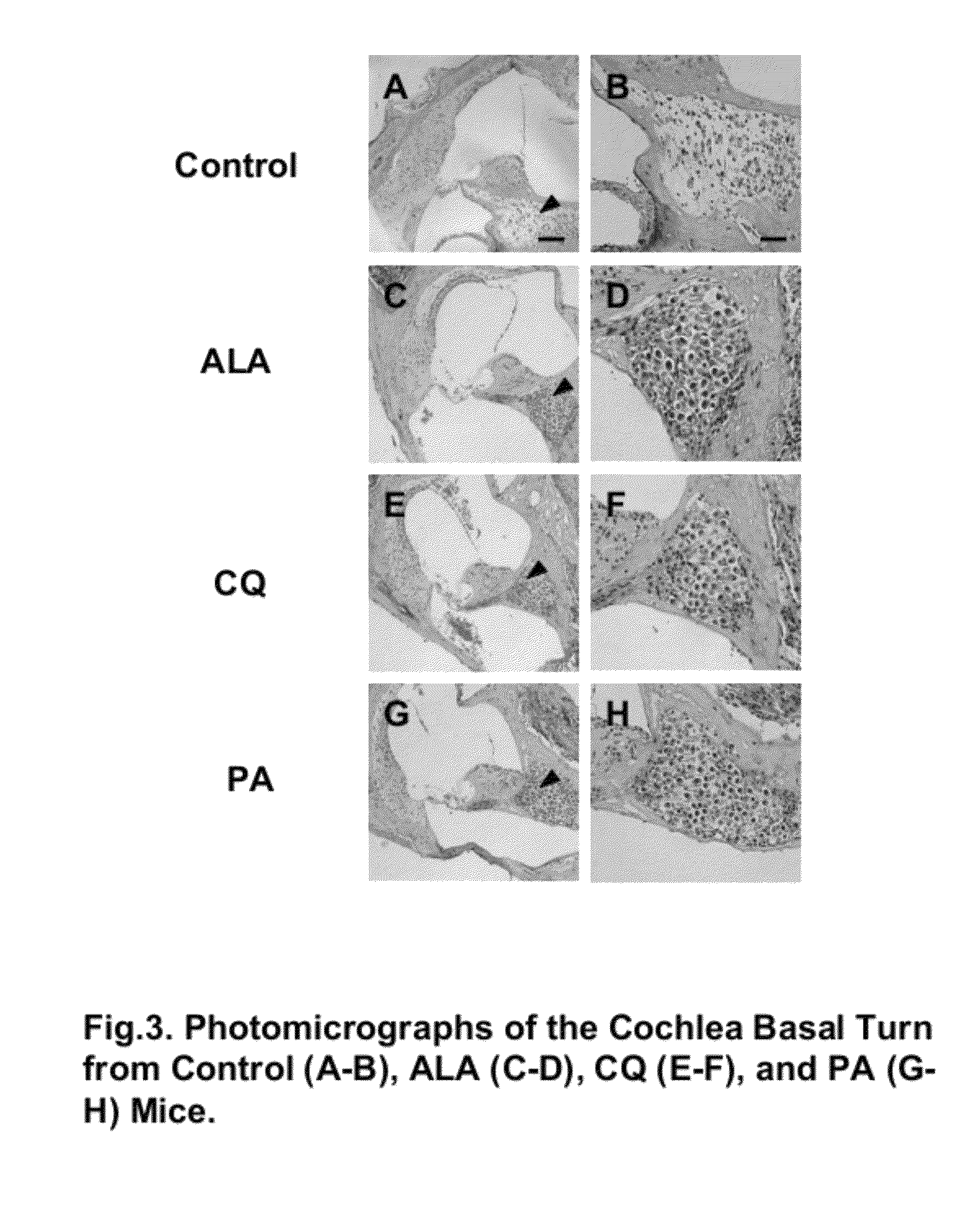 Compositions and methods for treating neurodegenerative diseases