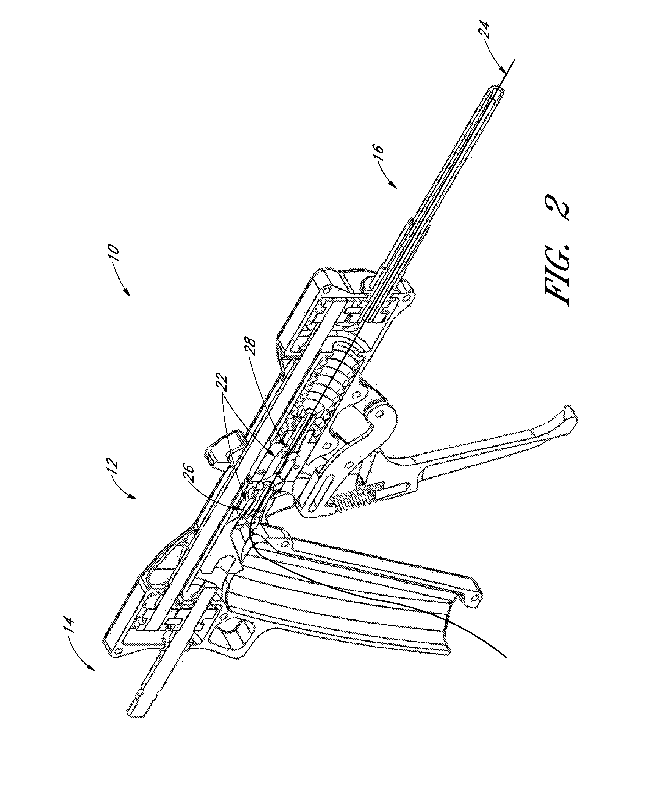 Device and method for tensioning an elongate member