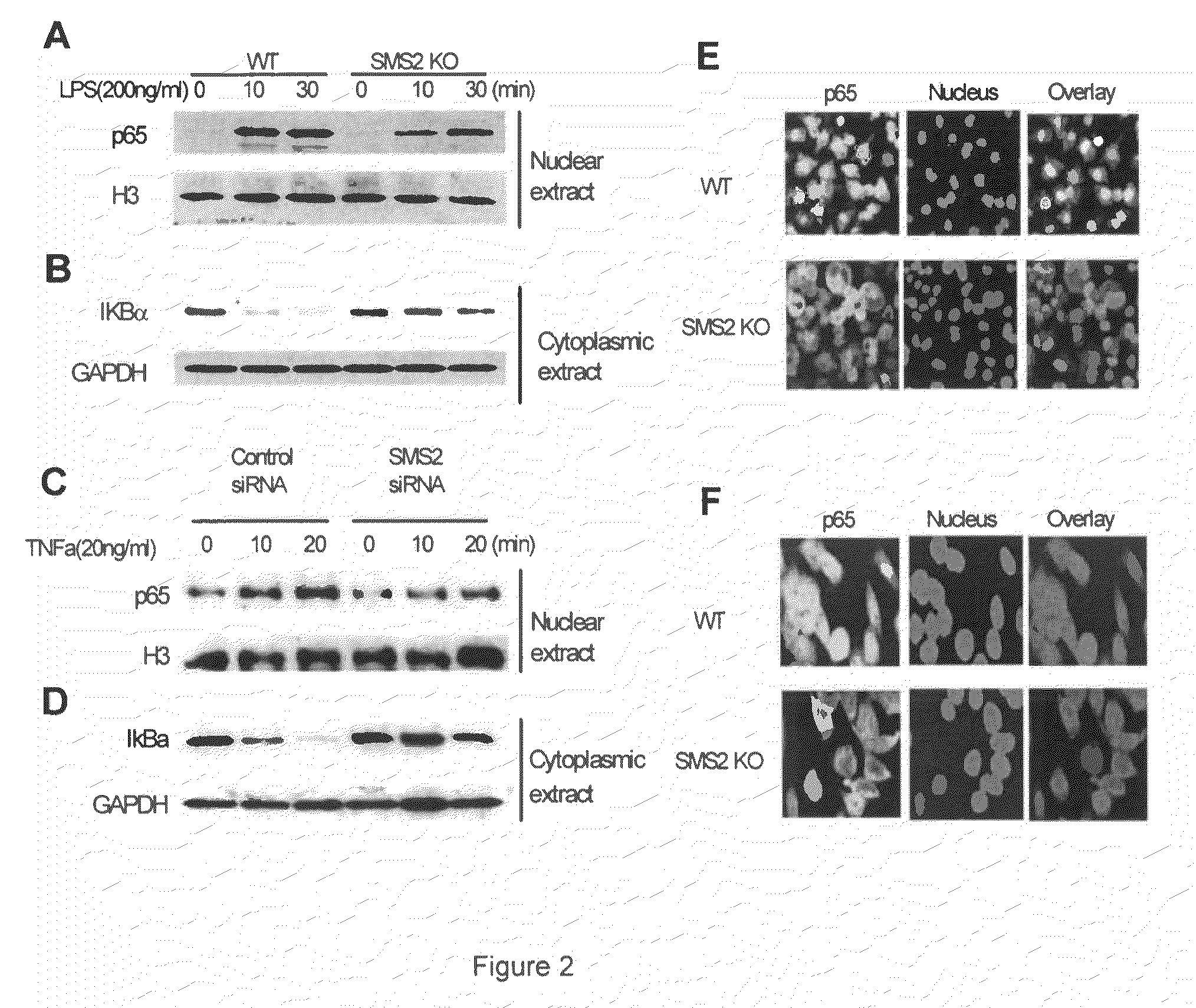 SPHINGOMYELIN SYNTHASE 2 (SMS2) DEFICIENCY ATTENUATES NFkB ACTIVATION, A POTENTIAL ANTI-ATHEROGENIC PROPERTY