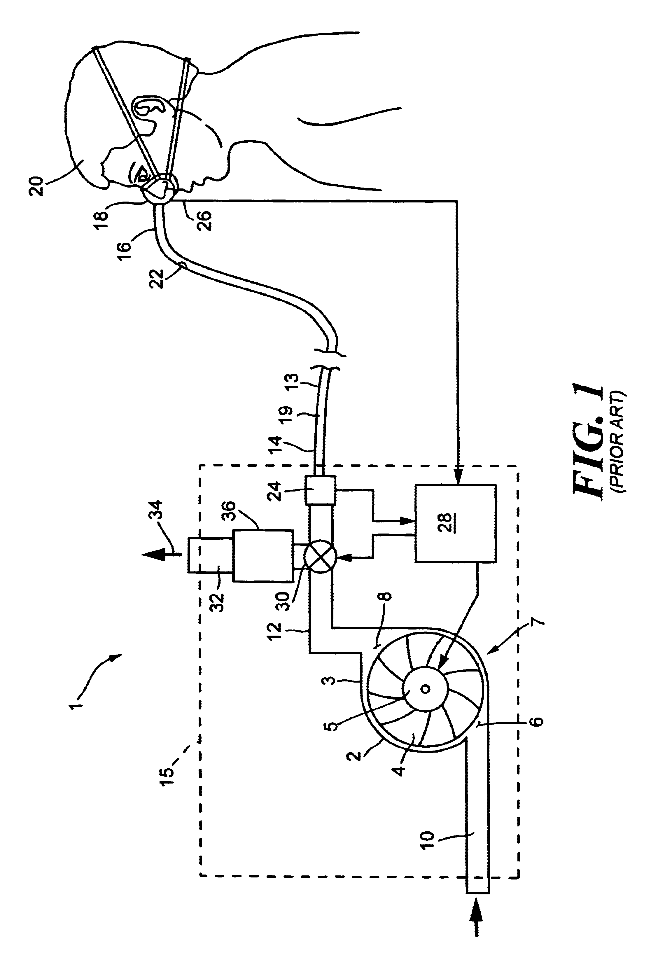 Pressure support system and method and a pressure control valve for use in such system and method