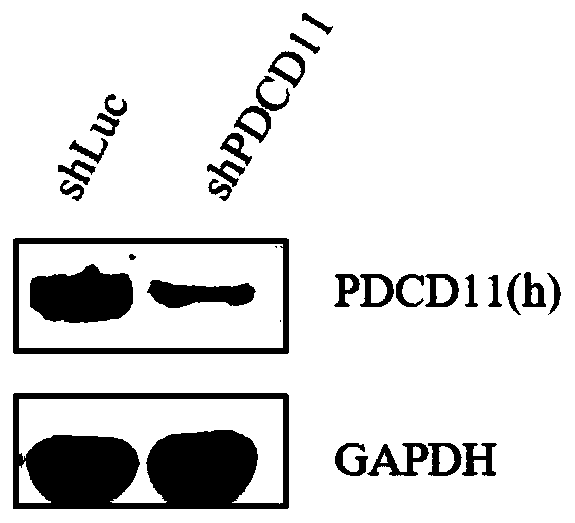 PDCD11-shRNA and application of PDCD11-shRNA in treatment of colorectal cancer