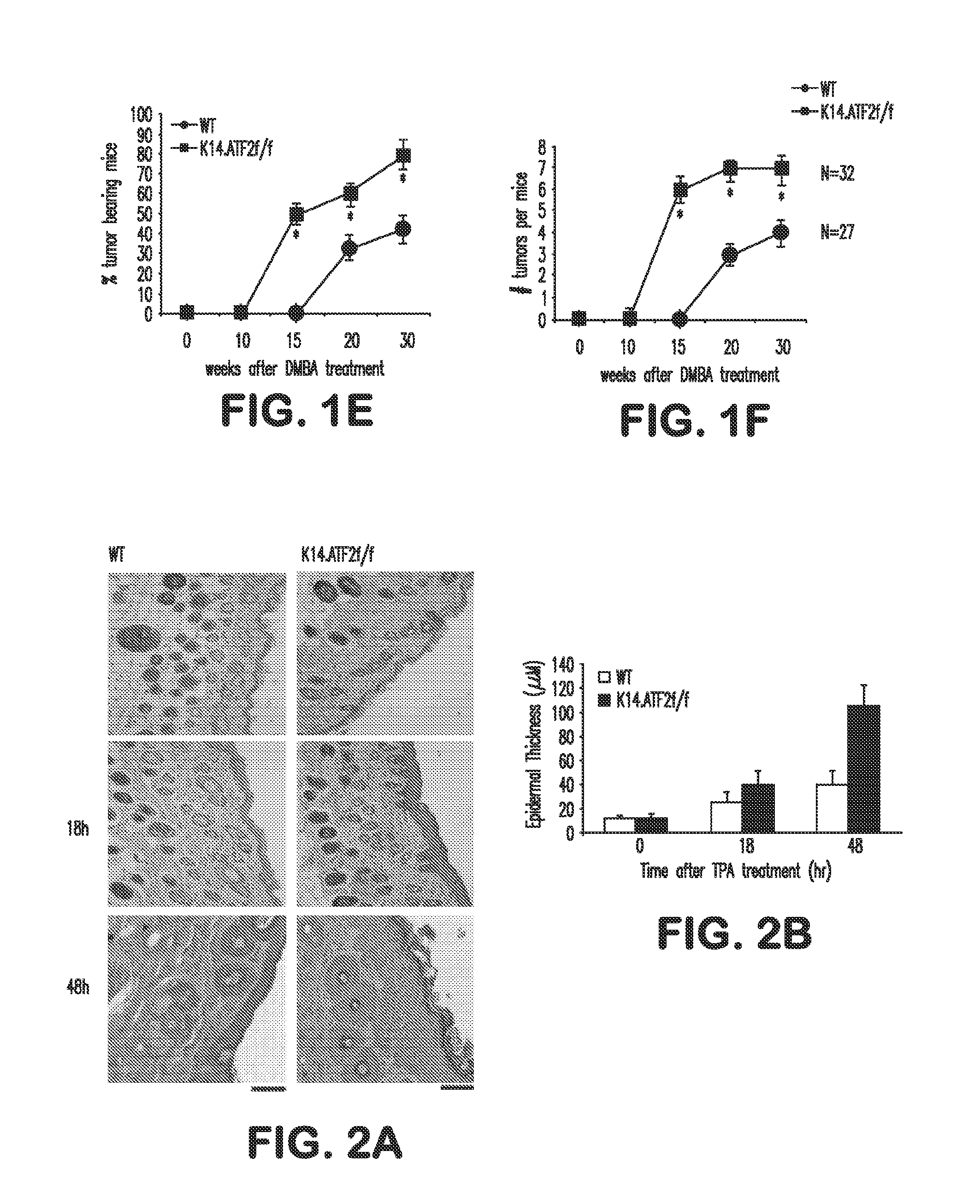 Use of Activating Transcription Factor-2 (ATF2) for Detecting Skin Cancer