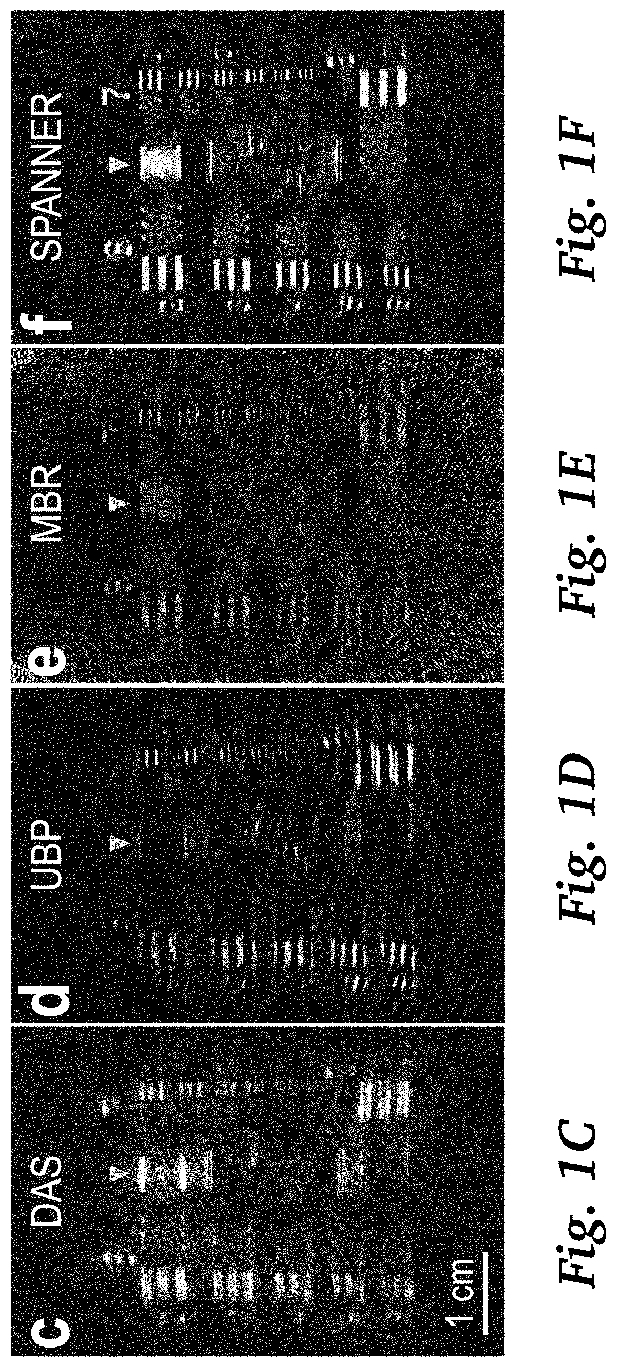 Real-time photoacoustic imaging using a precise forward model and fast iterative inverse