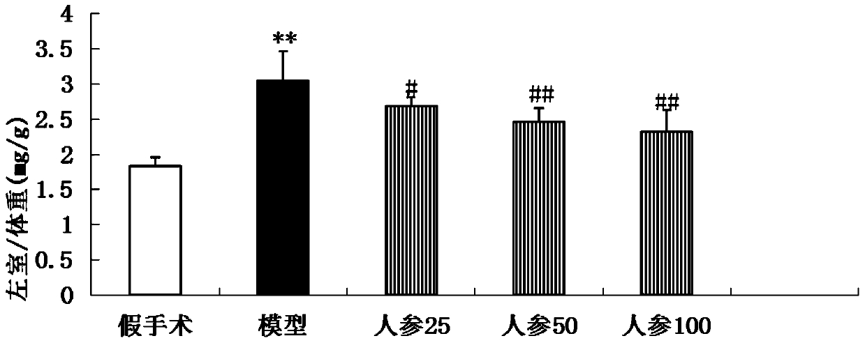 A kind of anti-myocardial hypertrophy pharmaceutical composition and preparation method thereof