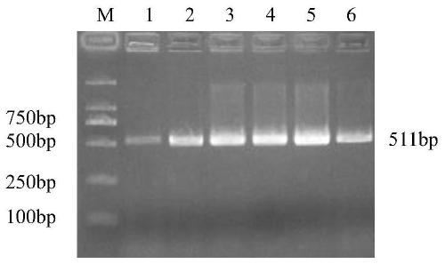 Recombinant lysed Salmonella enterica and construction method and application thereof