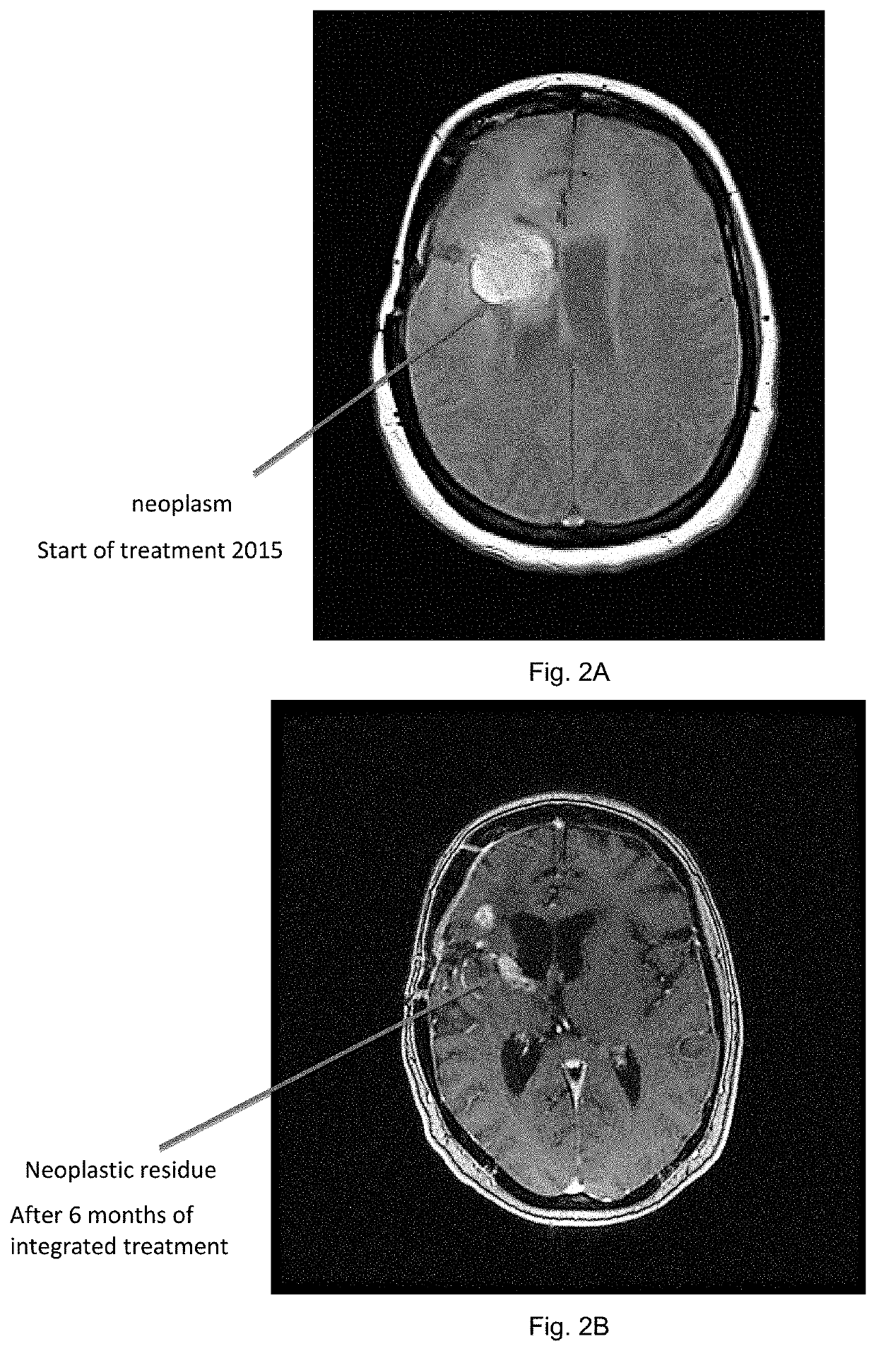 Compositions comprising resveratrolosides and curcumins