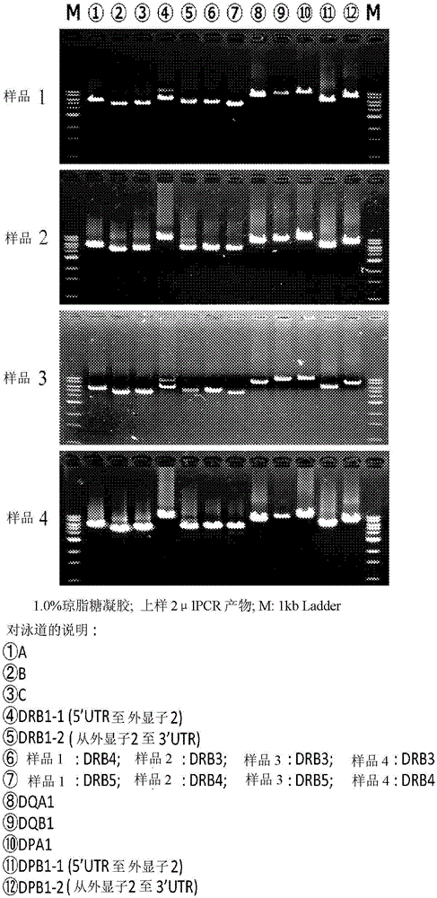 Hla gene multiplex dna typing method and kit