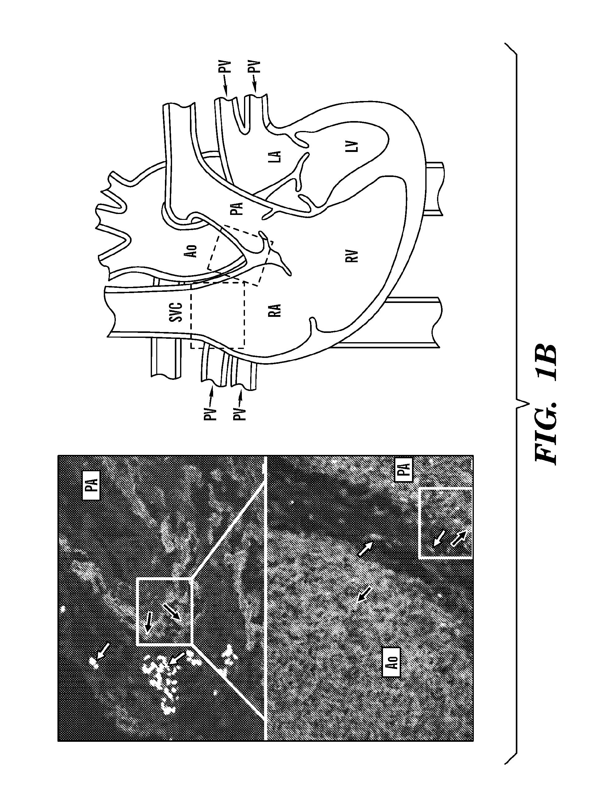 Generation of vascularized human heart tissue and uses thereof