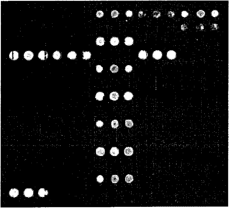 Gene chip for inspecting important intestinal tract peccant germ, its inspecting method and reagent kit