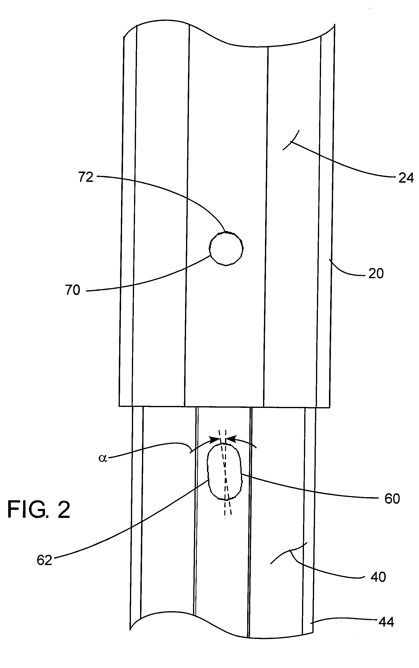 Telescoping Leg Lock and Portable Elevated Platform with Same